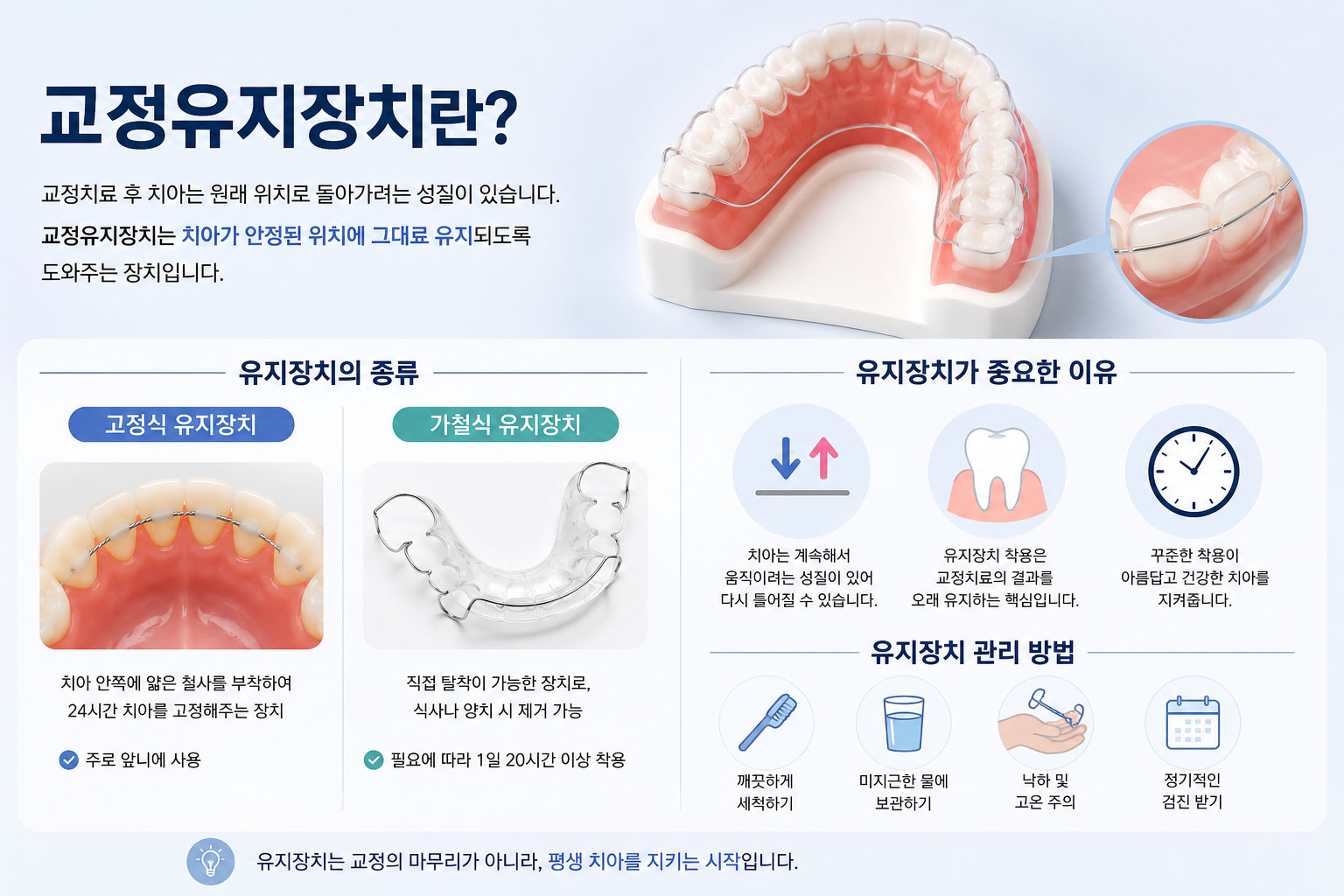 부천 유지장치 고정식 가철식 리테이너 종류 설명 연세바로치과 치과교정과 전문의