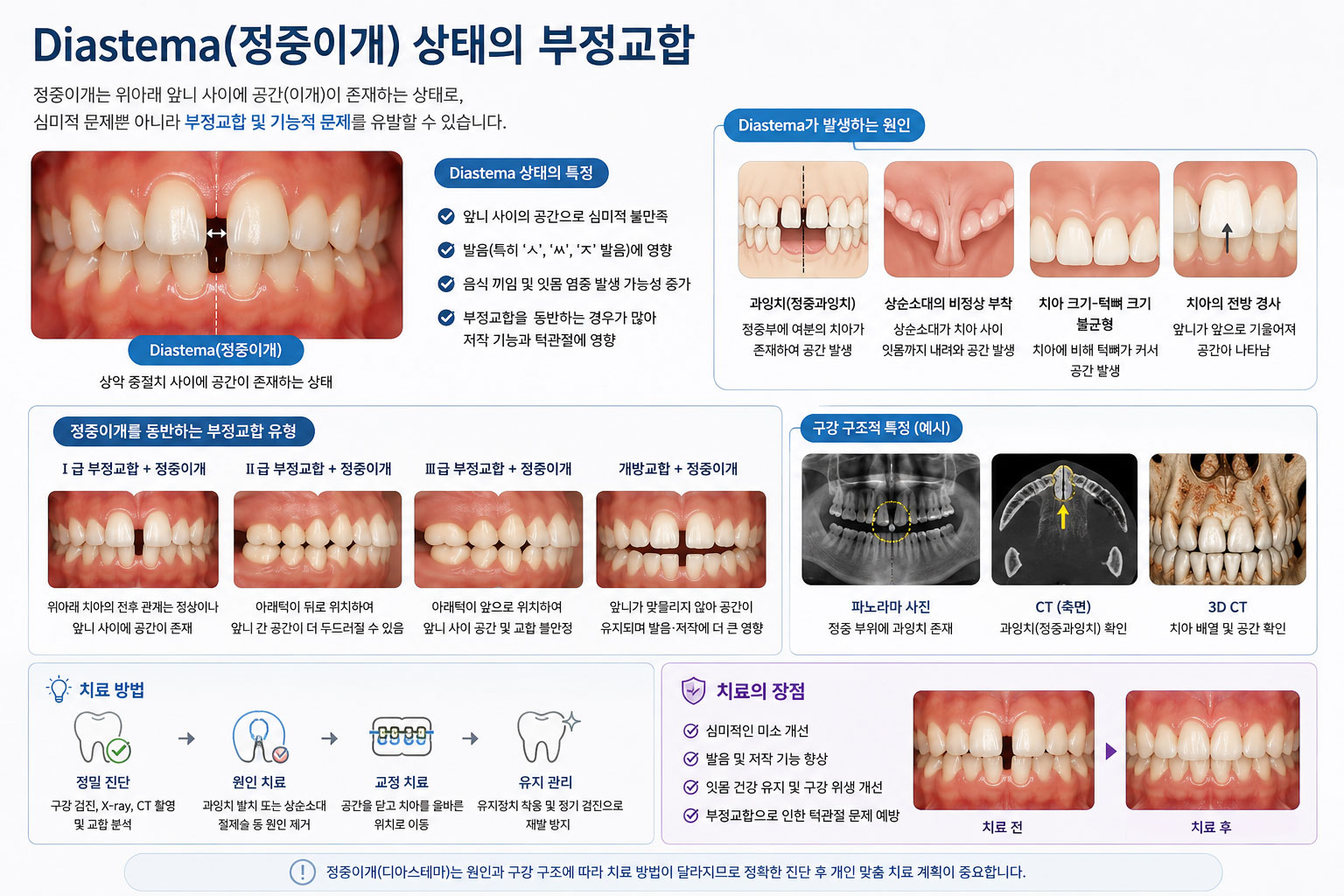 부천 정중이개 위 앞니 두 개 사이가 벌어진 치아 사이 틈 상태 설명 연세바로치과 치과교정과 전문의