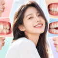 부천 교정 | 부정교합 종류·방법 종합 안내, 부천 연세바로치과